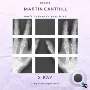 Martin Cantrill - X-Ray (2025)