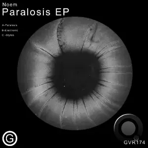 Noem - Paralosis (2025)